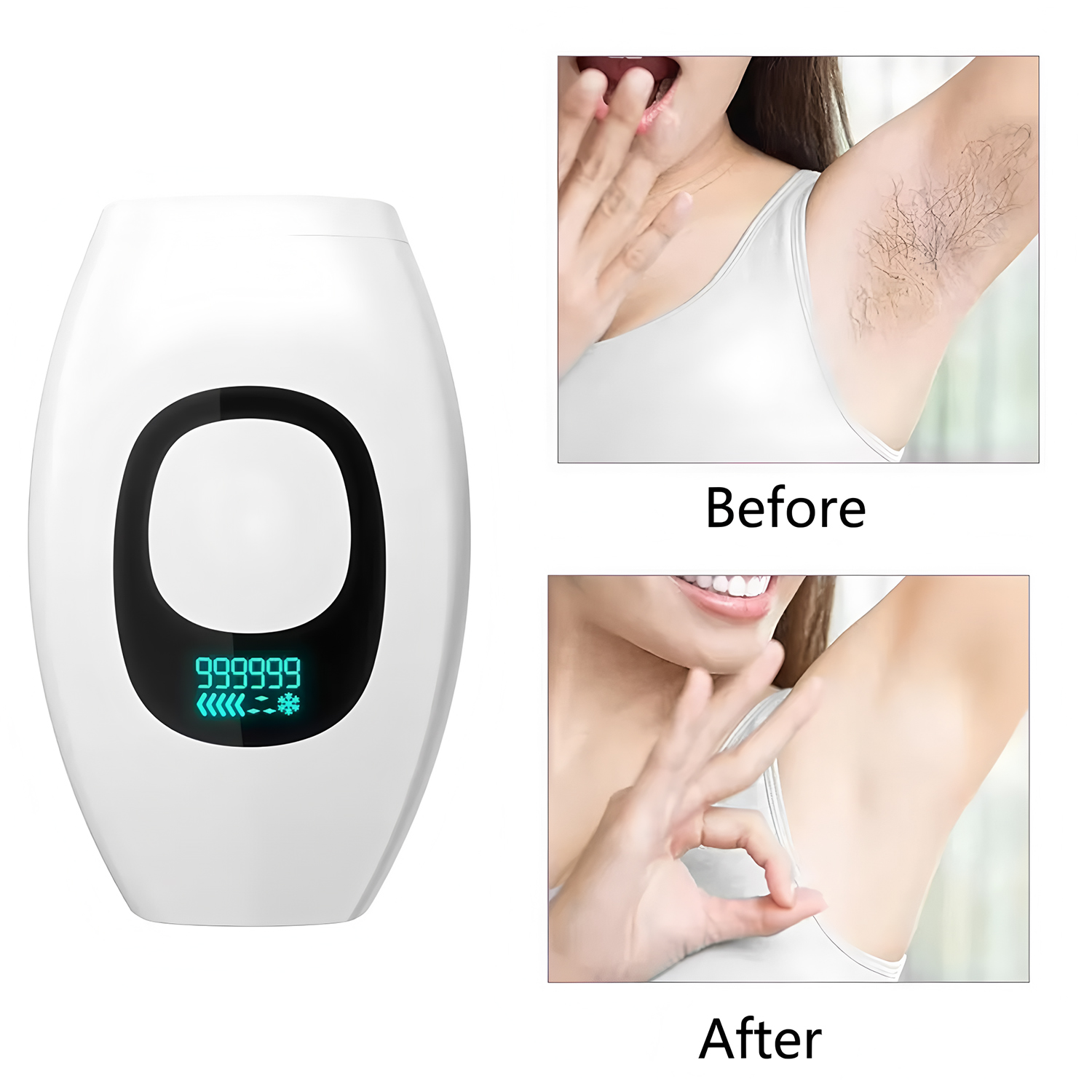 From Home Hair Care - Urządzenie do depilacji IPL 990000 impulsów,