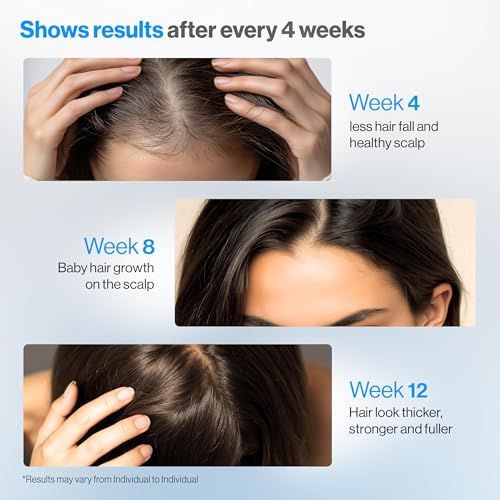 Premium Serum z Rozmarynem Prz – Hair Care For Hair Fall recenzja i cena