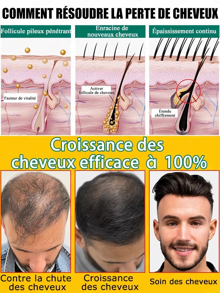 Codzienny płyn do odżywiania s – Hair Care For Hair Fall recenzja i cena