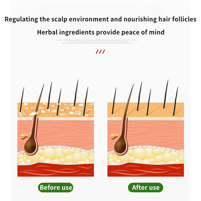 Sophora Flavescens Krem do wło – Hair Care Oil recenzja i cena
